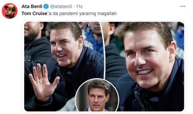 Tom Cruise’un yüzünün son hali hem basının hem de sosyal medyanın gündeminde. Hem yabancı hem de yerli Twitter kullanıcıları Tom Cruise’un bu değişimini diline dolamış durumda. Türkiye'deki bazı sosyal medya kullanıcıları Tom Cruise'u Kuşum Aydın'a benzetti.